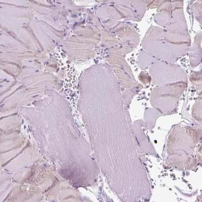Immunohistochemistry-Paraffin: Fatty Acid Synthase/FASN Antibody [NBP2-49213]
