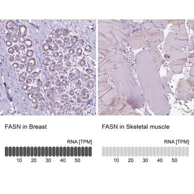 Immunohistochemistry-Paraffin: Fatty Acid Synthase/FASN Antibody [NBP2-49213]