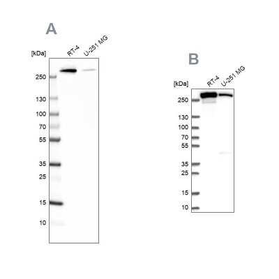 Western Blot: Fatty Acid Synthase/FASN Antibody [NBP1-84733]