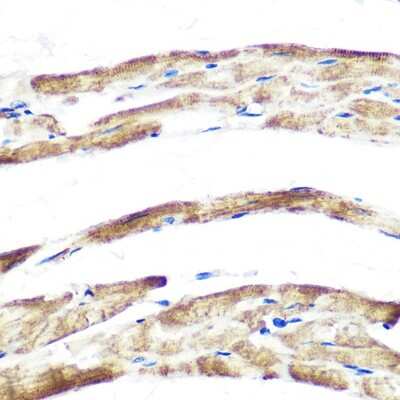 Immunohistochemistry-Paraffin: Fbx32 Antibody (1F10Z5) [NBP3-16255]