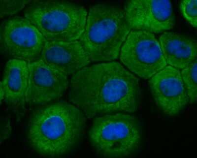 Immunocytochemistry/ Immunofluorescence: Fbx32 Antibody (JE41-27) [NBP2-76836]