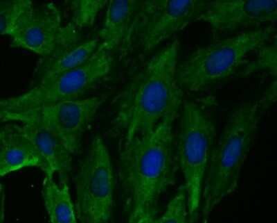 Immunocytochemistry/ Immunofluorescence: Fbx32 Antibody (JE41-27) [NBP2-76836]