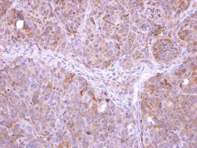Immunohistochemistry-Paraffin: FbxL12 Antibody [NBP1-31021]
