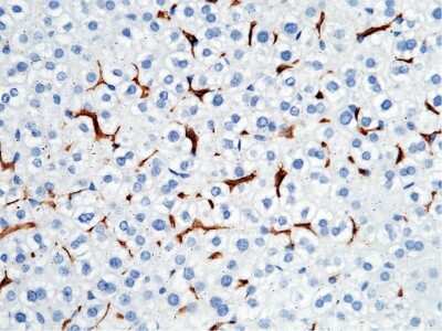 Immunohistochemistry-Paraffin: Fc gamma RI/CD64 Antibody (1) [NBP2-90403]
