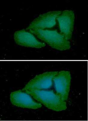 Immunocytochemistry/ Immunofluorescence: Fc gamma RI/CD64 Antibody (37F7) - BSA Free [NBP2-42685]