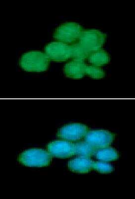 Immunocytochemistry/ Immunofluorescence: Fc gamma RI/CD64 Antibody (37F7) - BSA Free [NBP2-42685]