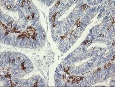 Immunohistochemistry: Fc gamma RI/CD64 Antibody (OTI1A8) - Azide and BSA Free [NBP2-70702]