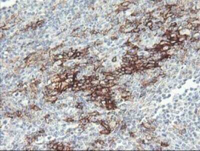 Immunohistochemistry: Fc gamma RI/CD64 Antibody (OTI1A8) - Azide and BSA Free [NBP2-70702]