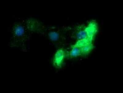 Immunocytochemistry/ Immunofluorescence: Fc gamma RI/CD64 Antibody (OTI1A8) [NBP2-45625]