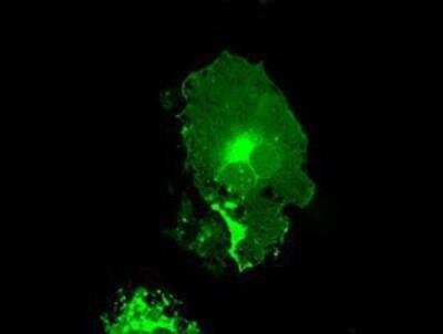 Immunocytochemistry/ Immunofluorescence: Fc gamma RIIA/CD32a Antibody (OTI9G5) [NBP1-47735]
