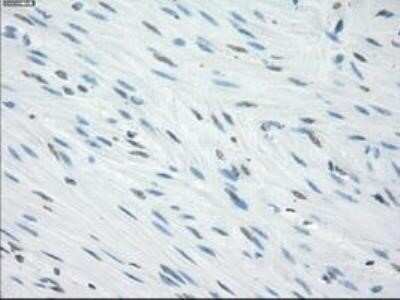 Immunohistochemistry: Fc gamma RIIA/CD32a Antibody (OTI9G5) - Azide and BSA Free [NBP2-70709]