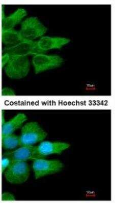 Immunocytochemistry/ Immunofluorescence: Fc gamma RIIB/CD32b Antibody [NBP2-14905]