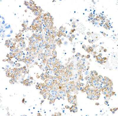 Immunohistochemistry: Fc gamma RIIIA/CD16a Antibody (BLR162J) [NBP3-14736]