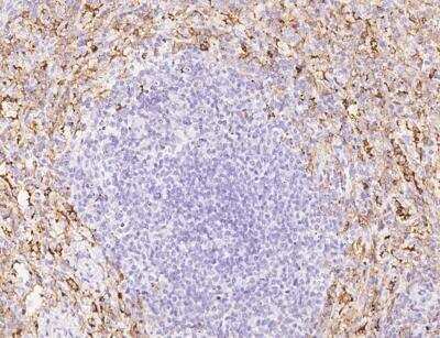 Immunohistochemistry-Paraffin: Fc gamma RIIIB/CD16b Antibody (24) [NBP3-12795]