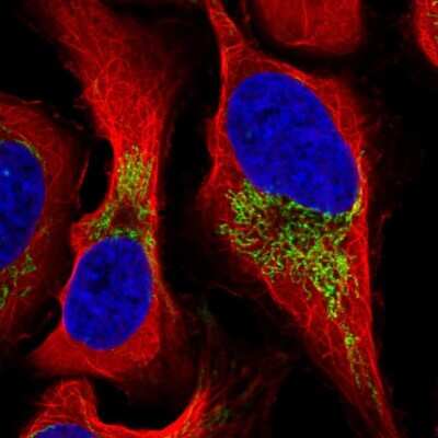 Immunocytochemistry/ Immunofluorescence: Ferredoxin Reductase Antibody [NBP2-38530]
