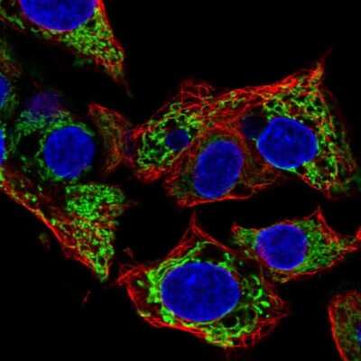 Immunocytochemistry/ Immunofluorescence: Ferredoxin Reductase Antibody [NBP2-38706]