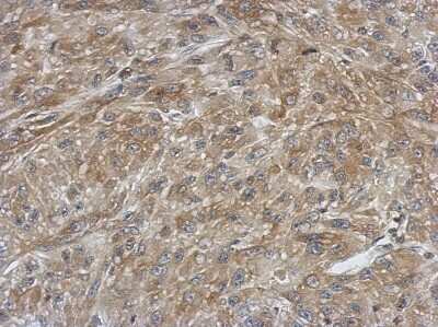 Immunohistochemistry-Paraffin: Ferredoxin Reductase Antibody [NBP2-16468]