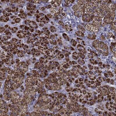 Immunohistochemistry-Paraffin: Ferredoxin Reductase Antibody [NBP2-38530]