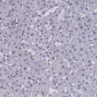 Immunohistochemistry-Paraffin: Ferredoxin Reductase Antibody [NBP2-38530]