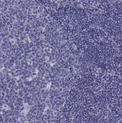 Immunohistochemistry-Paraffin: Ferredoxin Reductase Antibody [NBP2-38530]