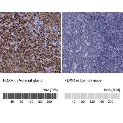 Immunohistochemistry-Paraffin: Ferredoxin Reductase Antibody [NBP2-38530]