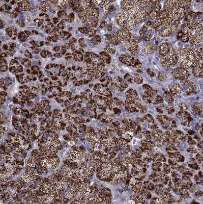 Immunohistochemistry-Paraffin: Ferredoxin Reductase Antibody [NBP2-38706]