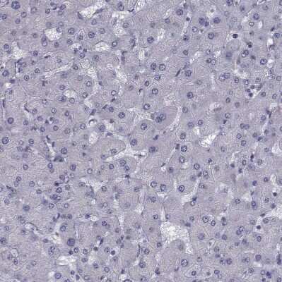 Immunohistochemistry-Paraffin: Ferredoxin Reductase Antibody [NBP2-38706]
