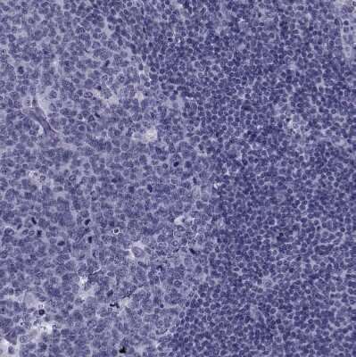 Immunohistochemistry-Paraffin: Ferredoxin Reductase Antibody [NBP2-38706]