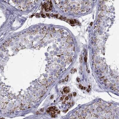 Immunohistochemistry-Paraffin: Ferredoxin Reductase Antibody [NBP2-38706]