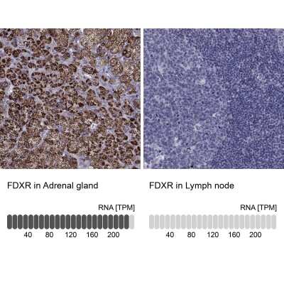 Immunohistochemistry-Paraffin: Ferredoxin Reductase Antibody [NBP2-38706]