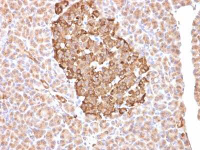Immunohistochemistry-Paraffin: Ferritin Antibody (FTH/2081) [NBP3-07795]