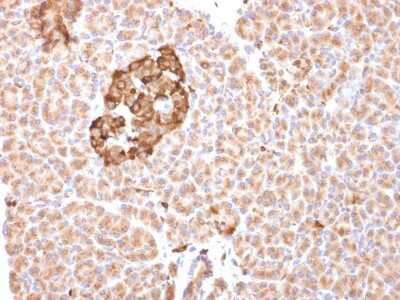Immunohistochemistry-Paraffin: Ferritin Antibody (FTH/2081) [NBP3-07795]
