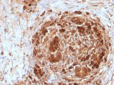 Immunohistochemistry-Paraffin: Ferritin Heavy Chain Antibody (FTH/2082) - Azide and BSA Free [NBP3-08613]
