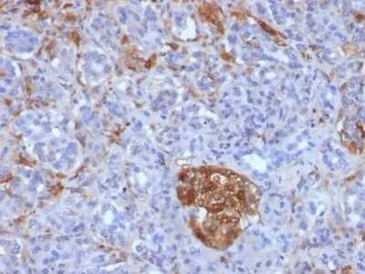 Immunohistochemistry-Paraffin: Ferritin Light Chain Antibody (FTL/1386) [NBP2-53295]