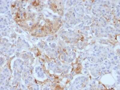 Immunohistochemistry-Paraffin: Ferritin Light Chain Antibody (FTL/1388) - Azide and BSA Free [NBP2-54584]