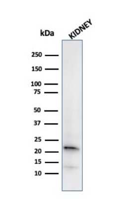 Western Blot: Ferritin Light Chain Antibody (FTL/2338R)Azide and BSA Free [NBP3-08620]