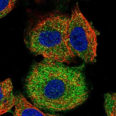 Immunocytochemistry/ Immunofluorescence: Ferritin Light Chain Antibody [NBP2-34072]