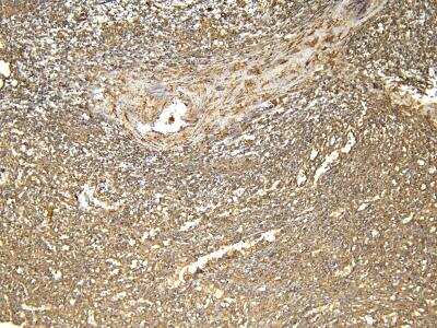 Immunohistochemistry: Ferritin Light Chain Antibody [NBP1-06986]