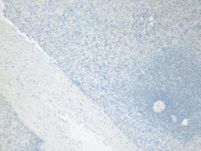 Immunohistochemistry: Ferritin Light Chain Antibody [NBP1-06986]