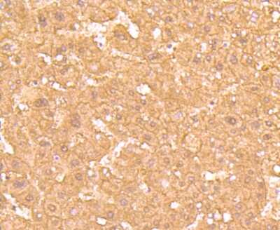Immunohistochemistry-Paraffin: Ferritin Light Chain Antibody (JM10-37) [NBP2-66836]