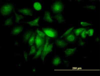 Immunocytochemistry/ Immunofluorescence: Ferritin Light Chain Antibody (X1) [H00002512-M16]