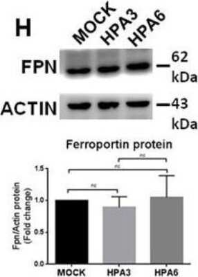 Western Blotting of Ferroportin/SLC40A1 in Control and Transfected HepG2 Cell Lines