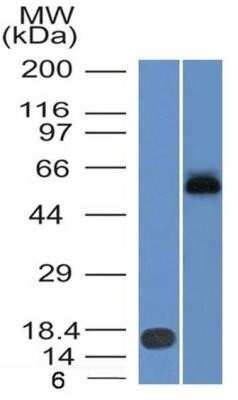 Western Blot: Ferroportin/SLC40A1 Antibody (8G10NB)Azide and BSA Free [NBP2-45357]