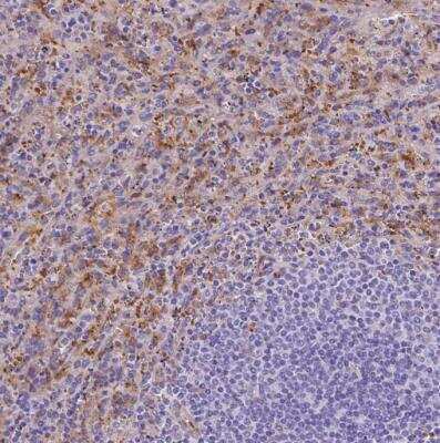 Immunohistochemistry-Paraffin: Ferroportin/SLC40A1 Antibody [NBP2-49454]