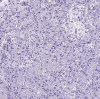 Immunohistochemistry-Paraffin: Ferroportin/SLC40A1 Antibody [NBP2-49454]