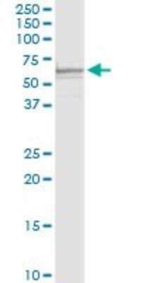Western Blot: Ferroportin/SLC40A1 Antibody [H00030061-D01P]