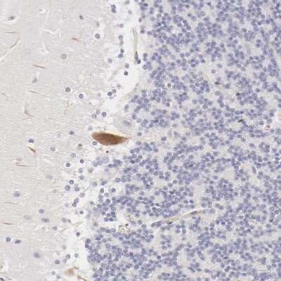 Immunohistochemistry-Paraffin: Fetuin A/AHSG Antibody [NBP1-90302]