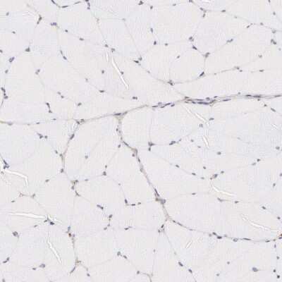 Immunohistochemistry-Paraffin: Fetuin A/AHSG Antibody [NBP1-90303]