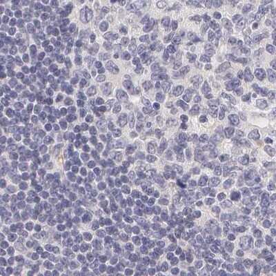 Immunohistochemistry-Paraffin: Fetuin A/AHSG Antibody [NBP1-90303]
