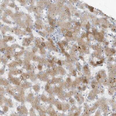 Immunohistochemistry-Paraffin: Fetuin Antibody [NBP1-91192]